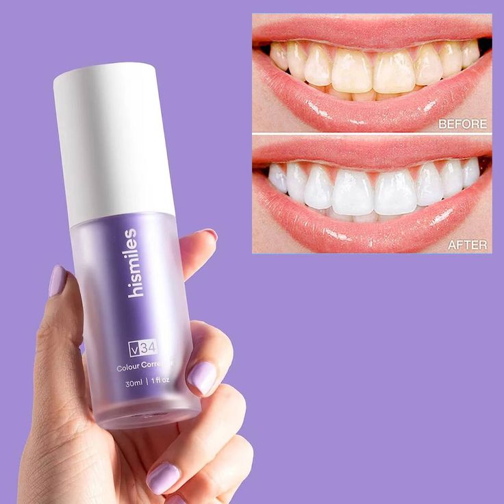 Hismile V34 Teeth Brightening Serum (100% Original)